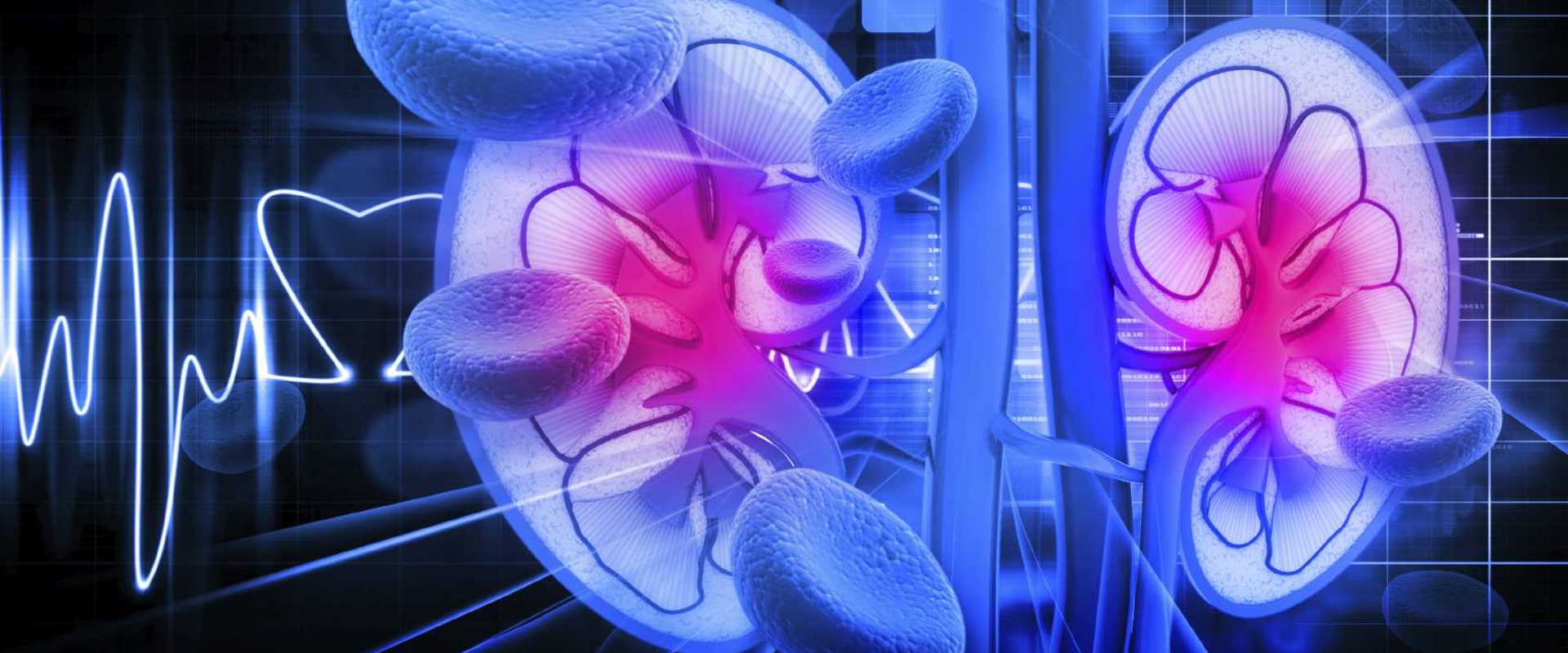 Diabetic Nephropathy Pathophysiology Definition Simplified: Stages and Treatment for All Diabetes Types